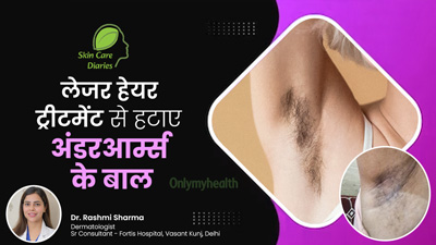 अंडरआर्म्स के बाल कम करने के लिए दीपा दुबे ने लिया लेजर ट्रीटमेंट, जानें कितना कारगर होता है यह ऑप्शन?
