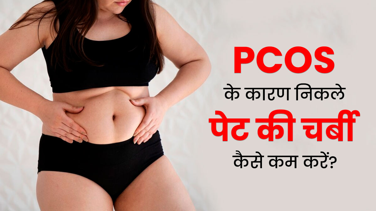 PCOS के कारण बढ़ गया है बेली फैट? तो इन टिप्स से करें कंट्रोल