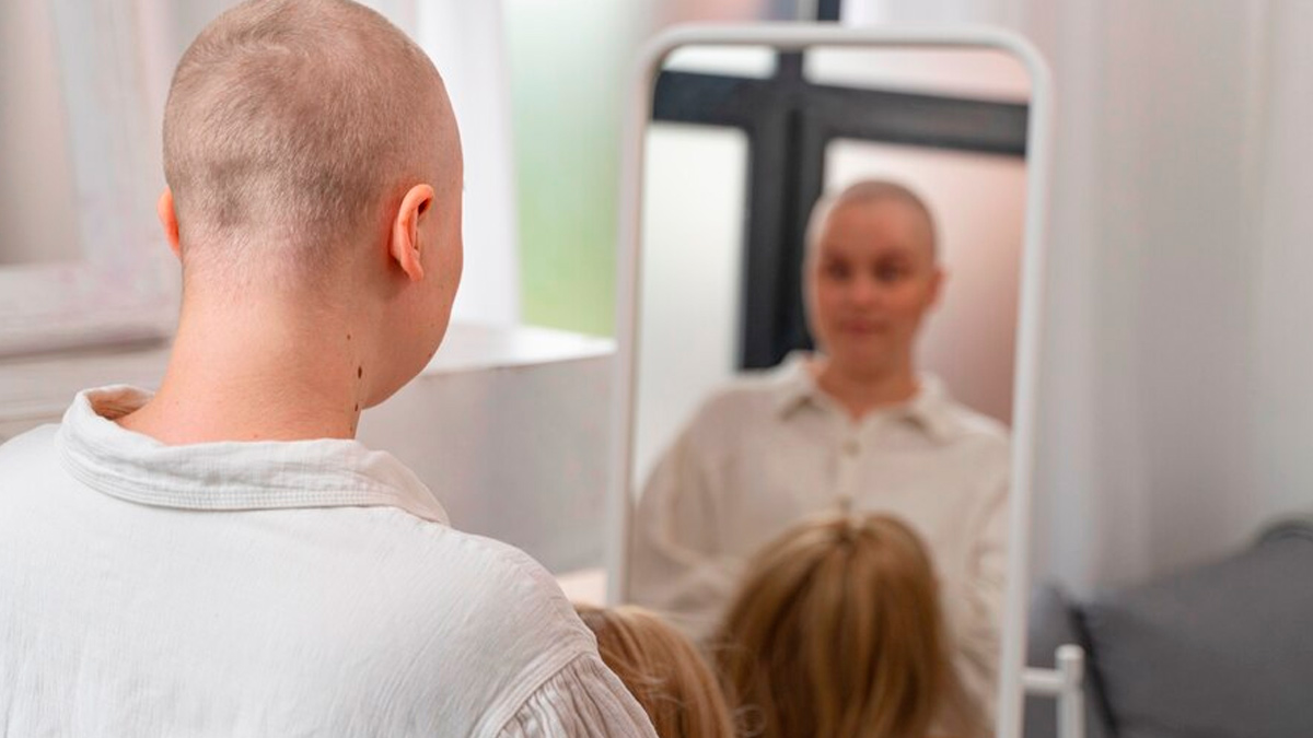 hair-loss-after-chemo