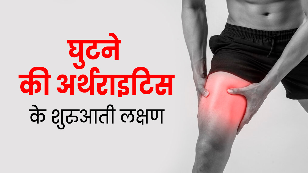घुटने की अर्थराइटिस की शुरुआत में दिखते हैं ये लक्षण, जानें बचाव