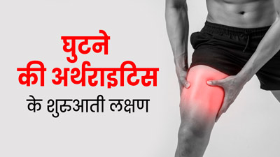 घुटने की अर्थराइटिस की शुरुआत में दिखते हैं ये लक्षण, जानें बचाव
