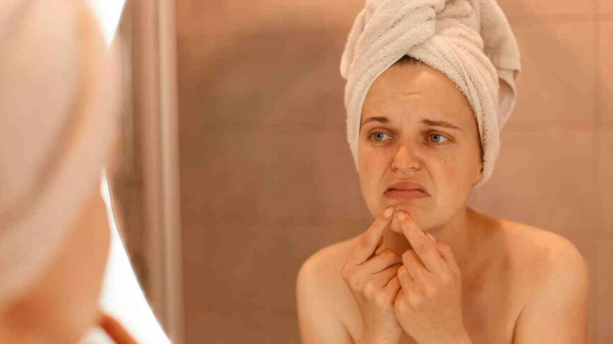 scleroderma in hindi