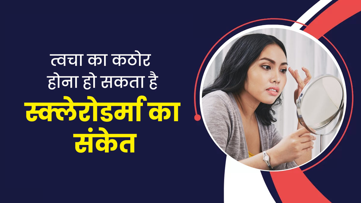 स्क्लेरोडर्मा की वजह से हो सकती है त्वचा पर सूजन, जानें इस ऑटोइम्यून बीमारी के लक्षण और कारण