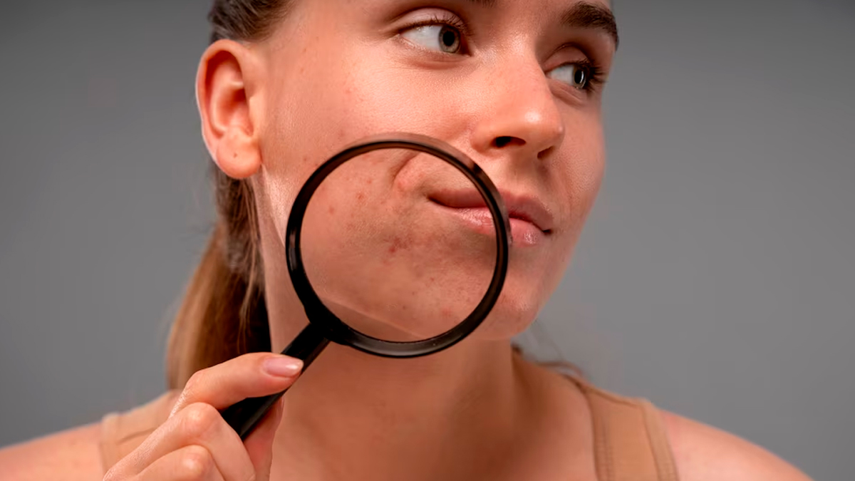 skin ralated issues