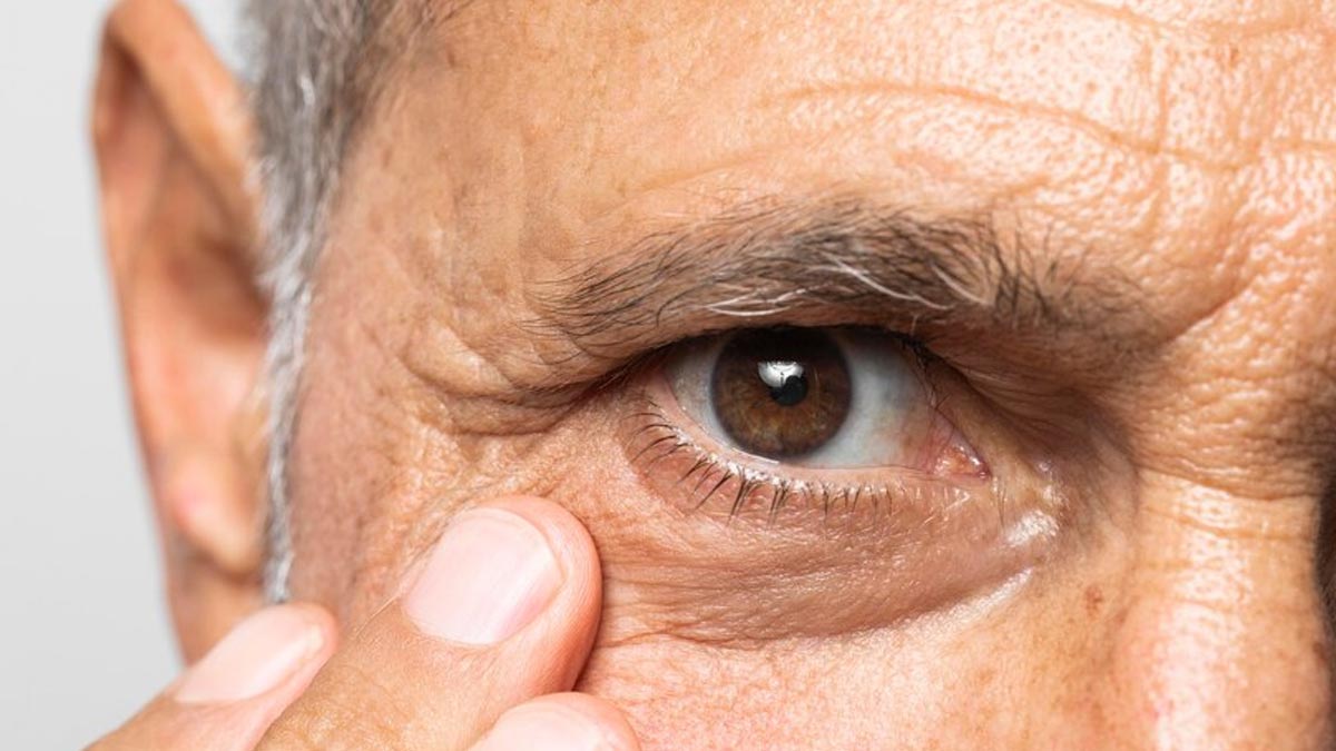 What Is Trabeculectomy Glaucoma Surgery? How Many Years Does It Last?
