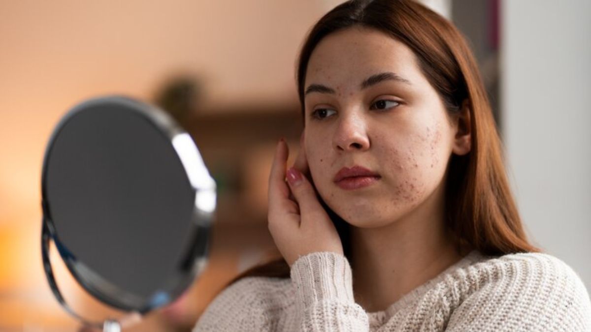 Understanding Skin Sensitivity During Monsoon