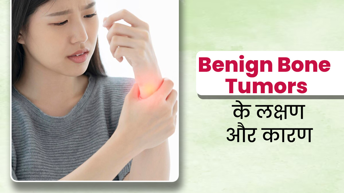 Benign Bone Tumor होने पर नजर आते हैं ये 3 लक्षण, जानें इसके कारण भी