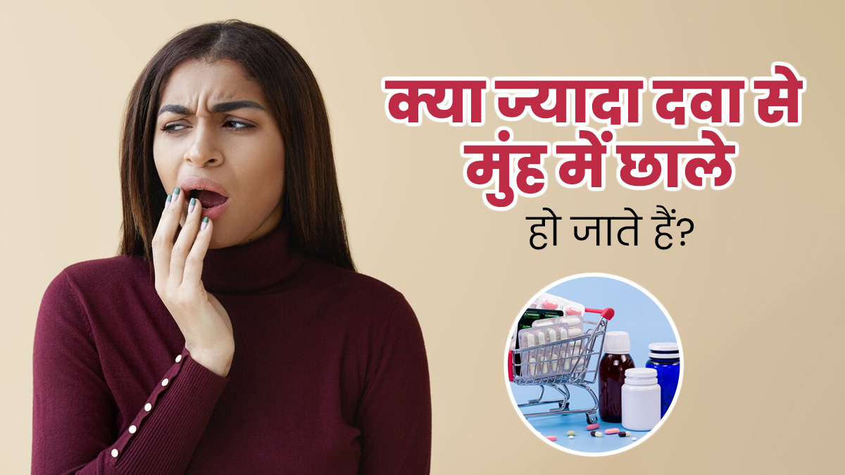 क्या ज्यादा दवा खाने से मुंह में छाले हो जाते हैं? एक्सपर्ट से जानें सच्चाई