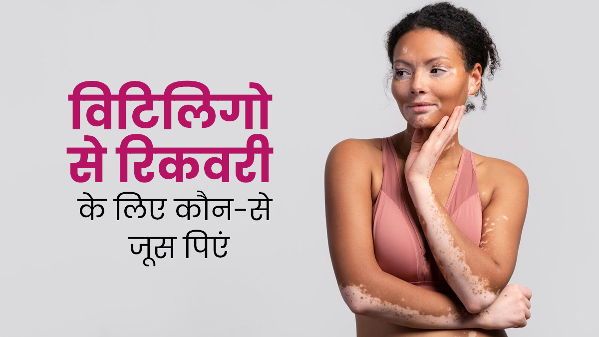 सफेद दाग की समस्या (विटिलिगो) से जल्द रिकवरी के लिए पिएं ये 5 जूस, जानें एक्सपर्ट से 