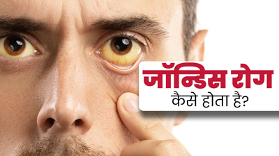 पीलिया रोग क्या है? डॉक्टर से जानें इस बीमारी के बारे में विस्तार से