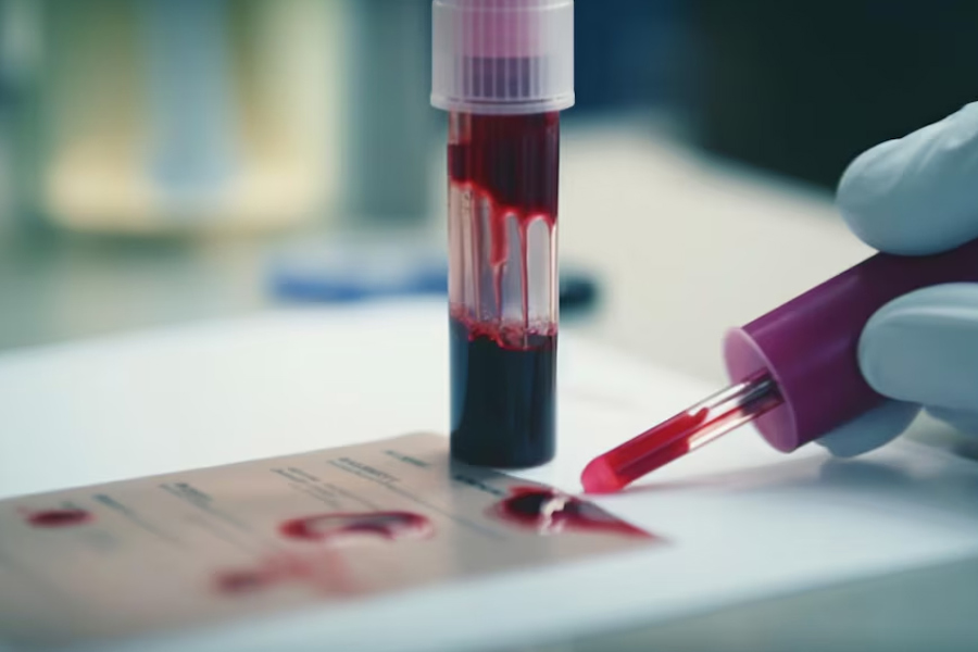 Complete blood count test