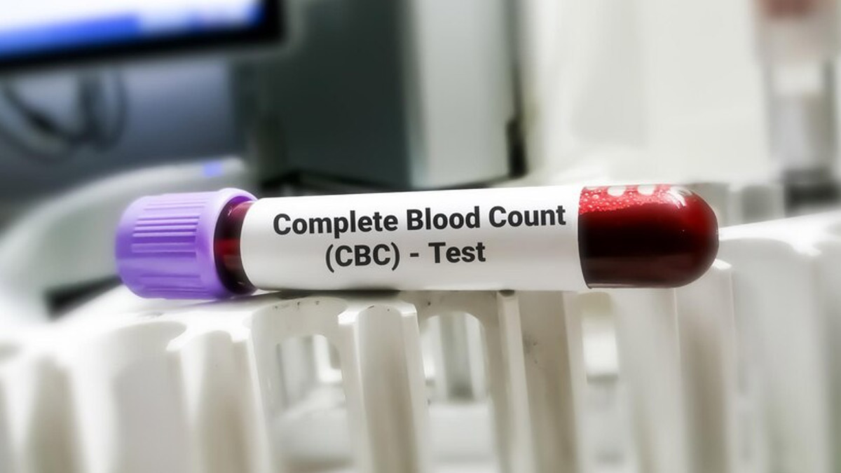 When Do You Need A Complete Blood Count (CBC) Test?