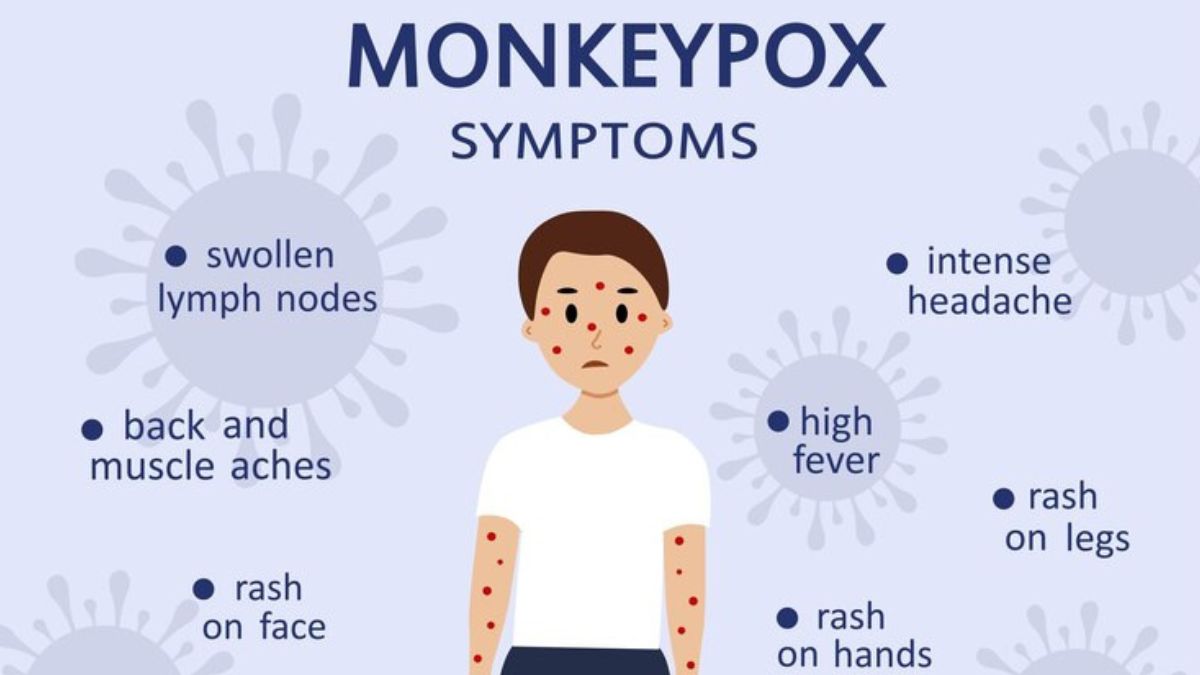 Monkeypox symptoms