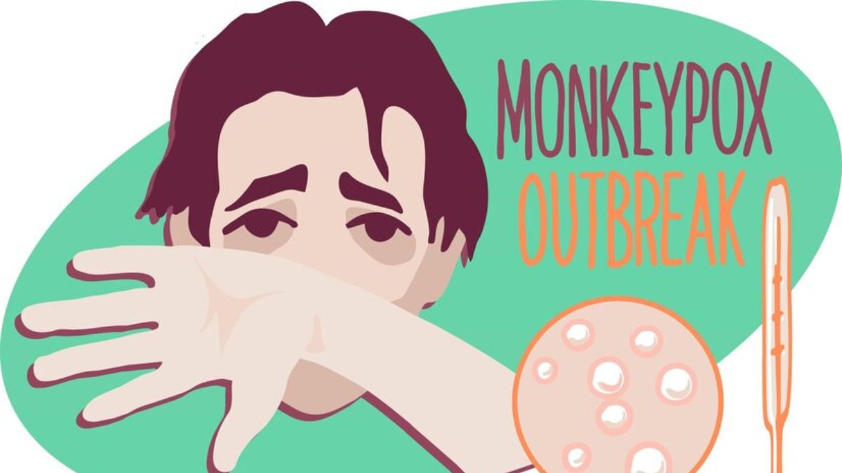 Monkeypox Outbreak in Africa: Know The Symptoms, Causes, Diagnosis and Treatment of Monkeypox