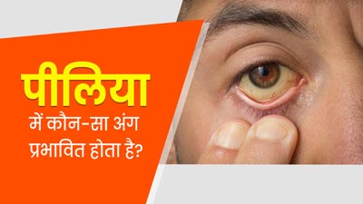 पीलिया में शरीर का कौन-सा अंग ज्यादा प्रभावित होता है? एक्सपर्ट से जानें इसके बारे में