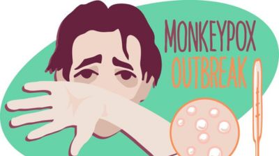 Monkeypox Outbreak in Africa: Know The Symptoms, Causes, Diagnosis and Treatment of Monkeypox