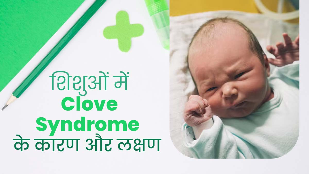 शिशुओं में रीढ़ की हड्डी और किडनी की समस्या का कारण हो सकता है Clove Syndrome, जानें इसके कारण और लक्षण