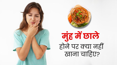 मुंह में छाले होने पर न खाएं ये 4 चीजें, जल्द मिलेगी राहत