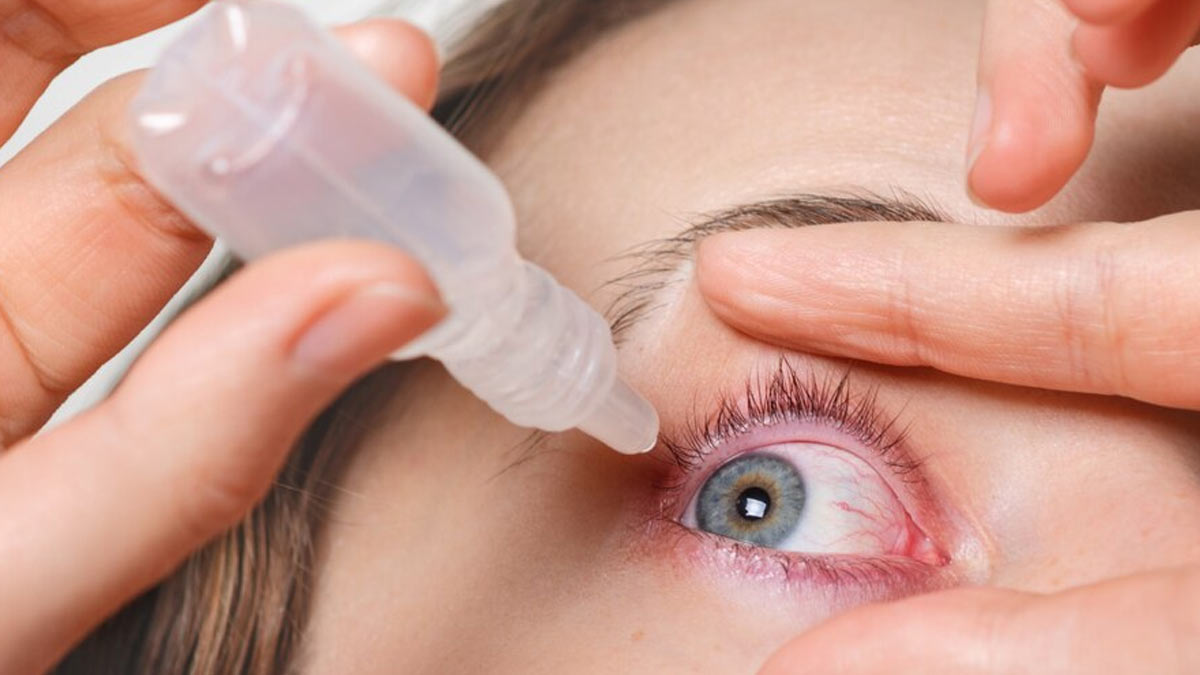 How To Reduce Redness In Your Eyes Upon Waking Up