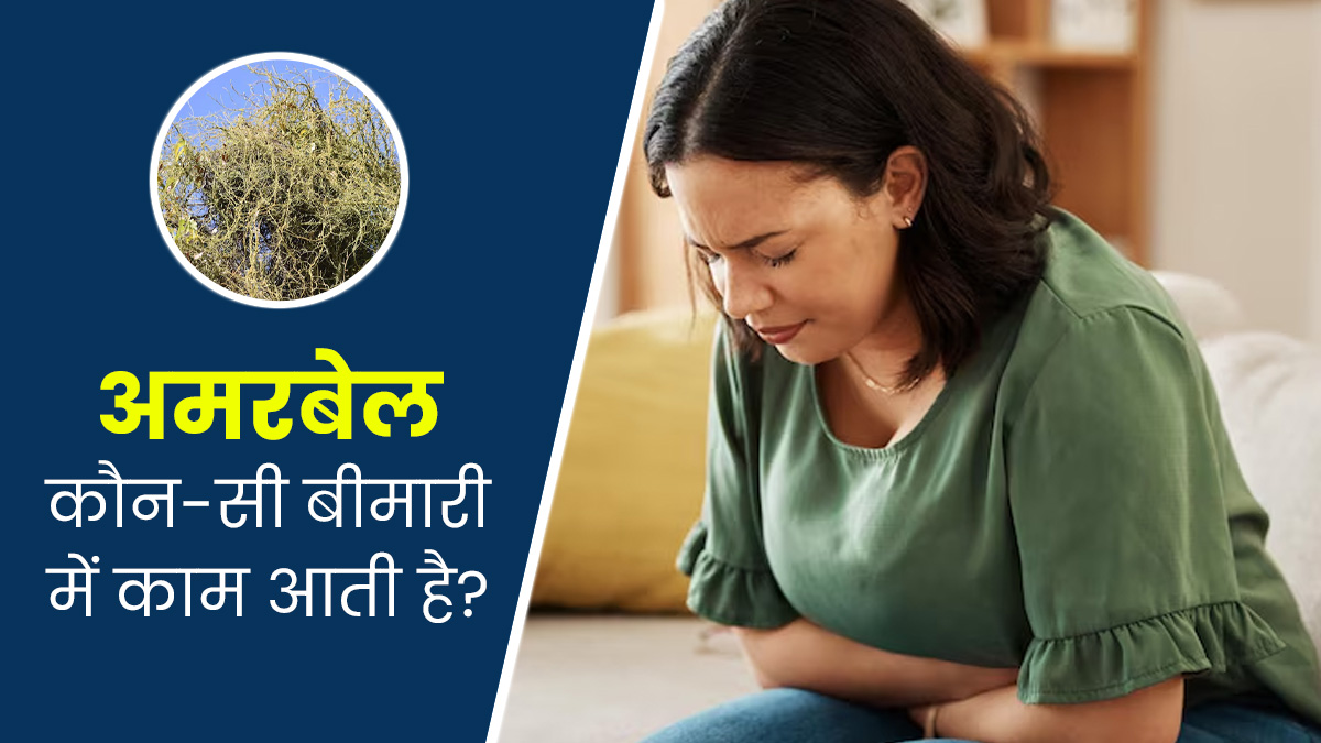 Amarbel Benefits: अमरबेल कौन-सी बीमारी में काम आती है? जानें आयुर्वेदिक एक्सपर्ट से