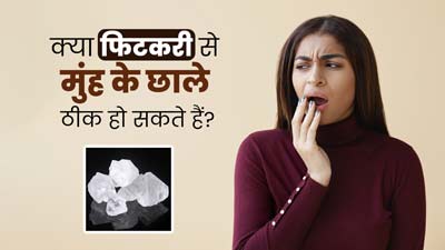 Mouth Ulcer: क्या फिटकरी का इस्तेमाल करने से मुंह के छाले ठीक हो सकते हैं? आयुर्वेदाचार्य से जानें