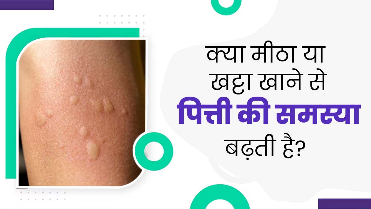 क्या मीठा या खट्टा खाने से पित्ती की समस्या बढ़ सकती है? जानें एक्सपर्ट से