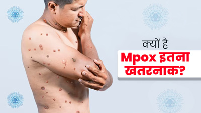 Mpox Outbreak: क्यों है Mpox इतना खतरनाक? जानें इस बीमारी की हिस्ट्री और बचाव के तरीके