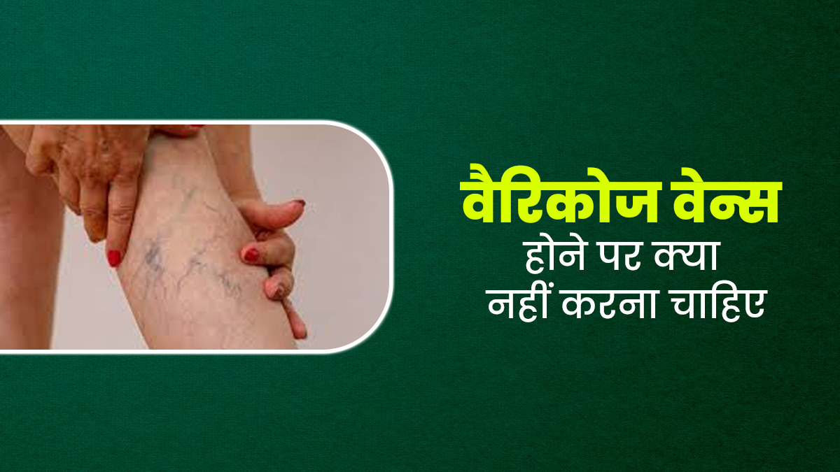 वैरिकोज वेन्स की परेशानी को बढ़ा सकती हैं ये 5 चीजें, आज ही छोड़ें; वरना बढ़ सकती है परेशानी
