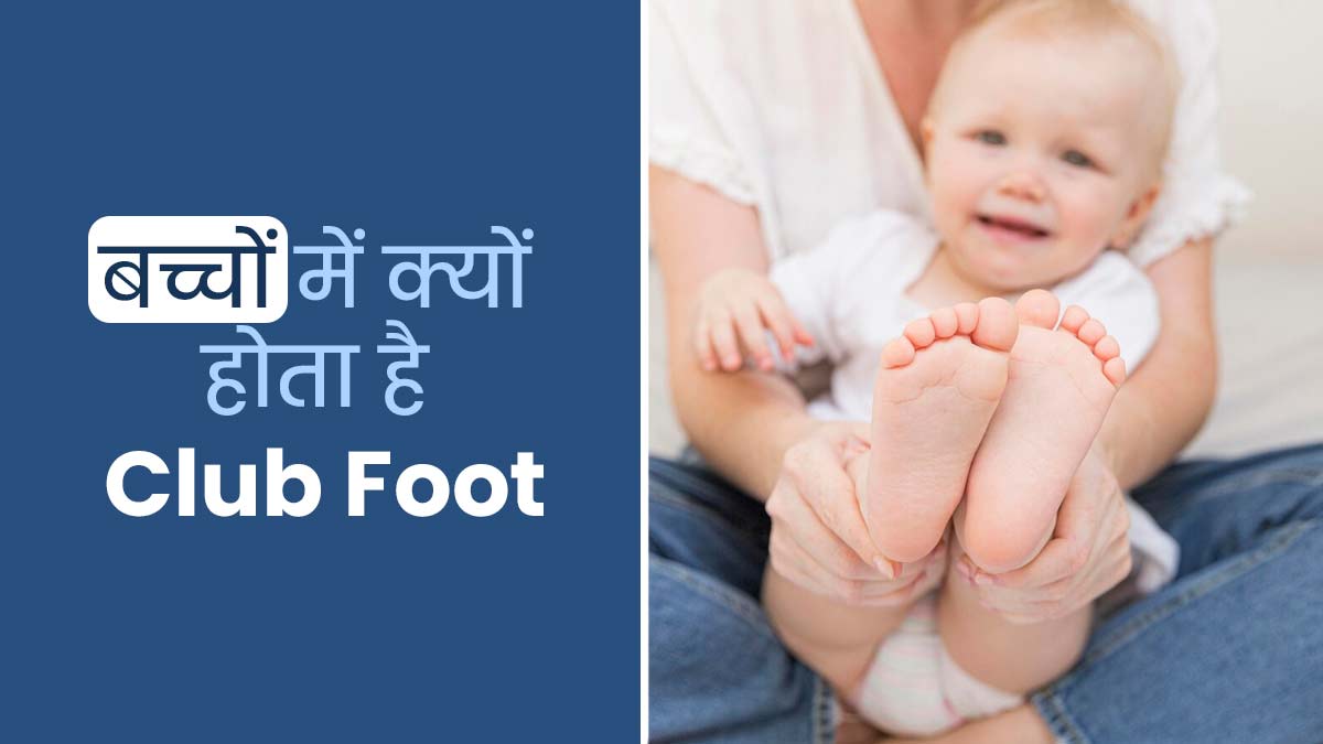 बच्चों में आम है क्लब फुट (पैर अंदर की ओर मुड़ जाना) की समस्या, डॉ. इमरान से जानें इसके कारण और इलाज