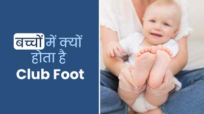 बच्चों में आम है क्लब फुट (पैर अंदर की ओर मुड़ जाना) की समस्या, डॉ. इमरान से जानें इसके कारण और इलाज