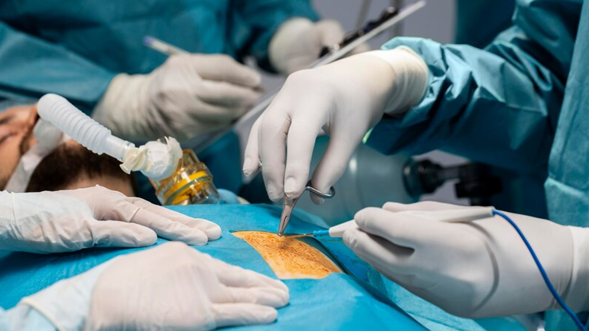 kidney-donation-surgery-