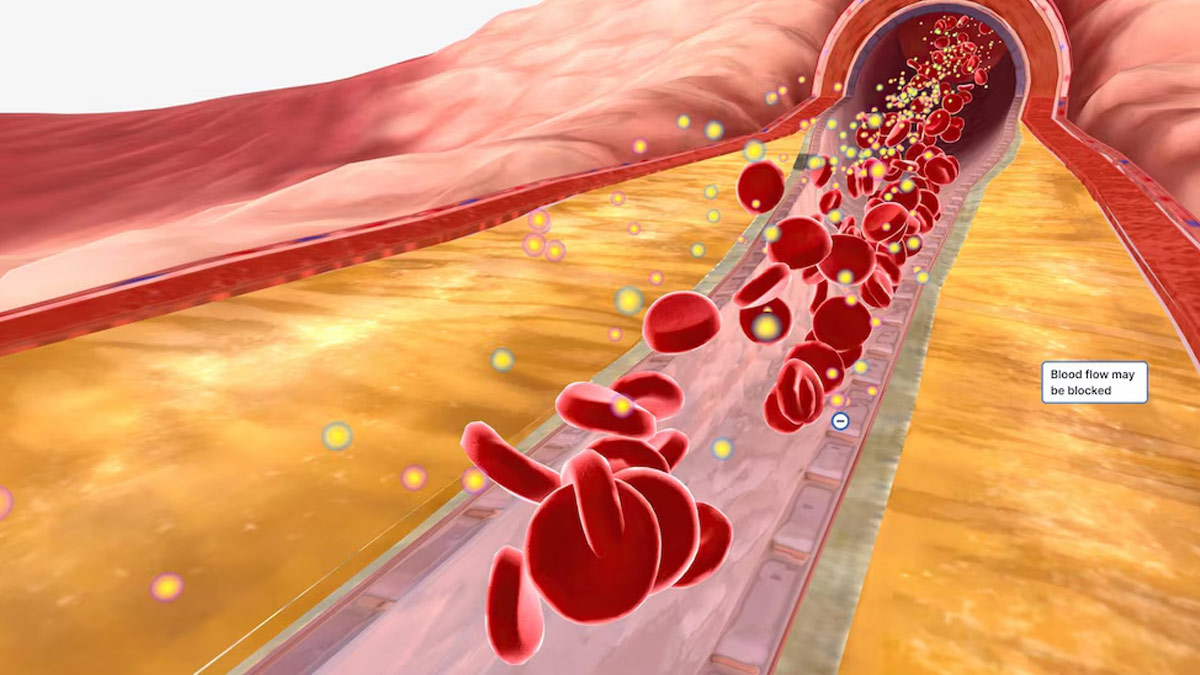 tips-to-manage-cholesterol