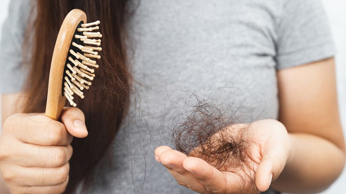 hair-loss