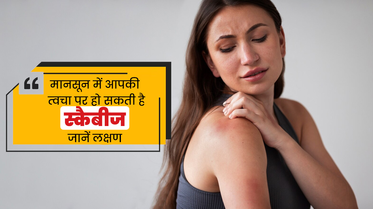 मानसून में आपकी त्वचा पर हो सकती है स्कैबीज, जानें इसके 5 मुख्य लक्षण 