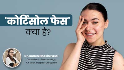'कोर्टिसोल फेस' क्या है? डॉ. रुबेन से जानें TikTok पर वायरल हो रही इस स्किन कंडीशन के बारे में
