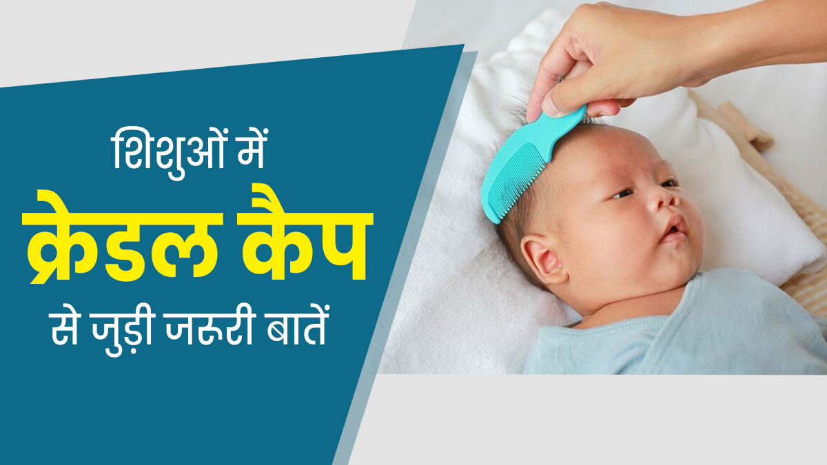 शिशुओं में क्रेडल कैप (स्कैल्प पर पपड़ी-डैंड्रफ) की समस्या से जुड़ी ये 5 बातें, हर पेरेंट्स को जरूर होनी चाहिए