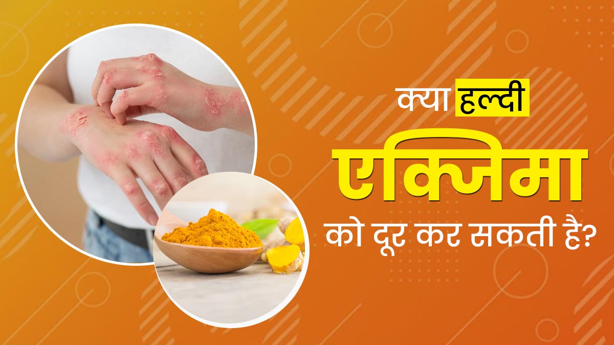 क्या हल्दी एक्जिमा को दूर कर सकती है? आयुर्वेदाचार्य से जानें