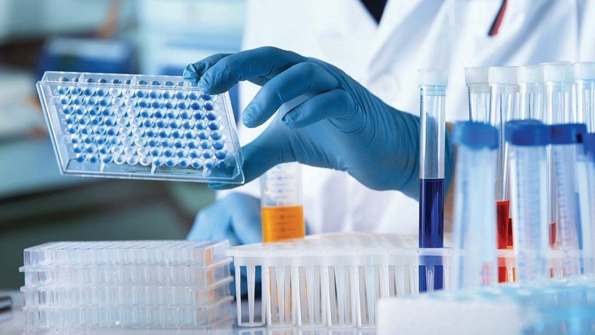 elisa test report