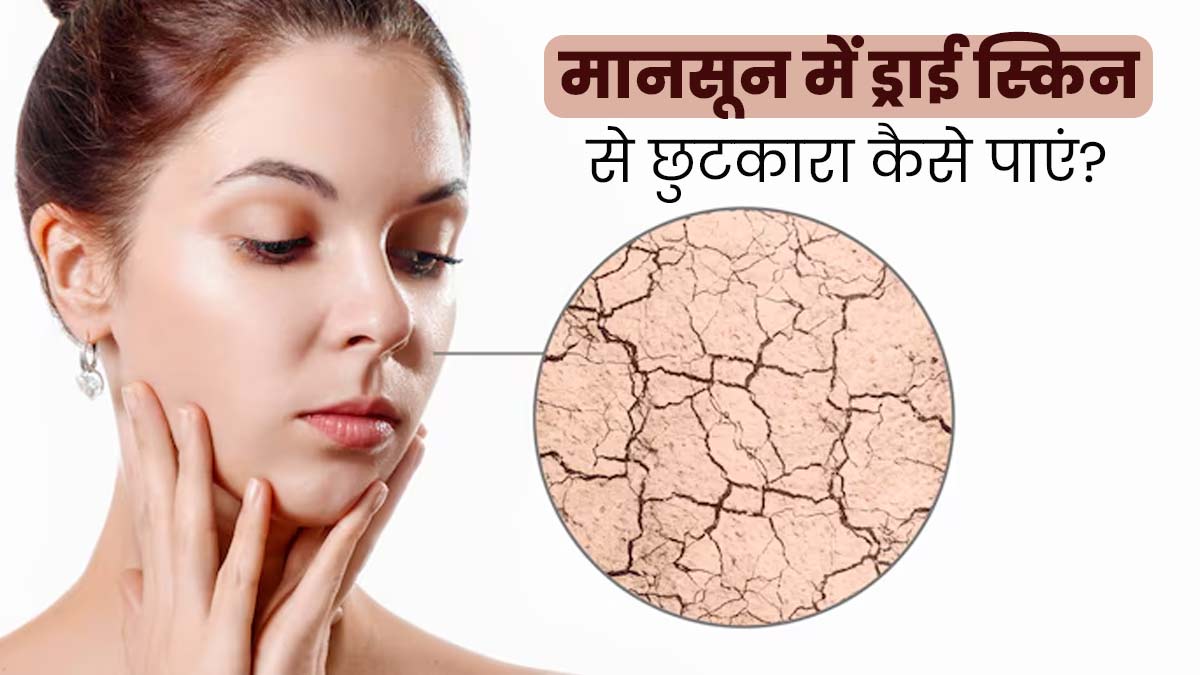 मानसून में ड्राई स्किन से छुटकारा पाने के लिए करें ये 5 काम, स्किन रहेगी हेल्दी 