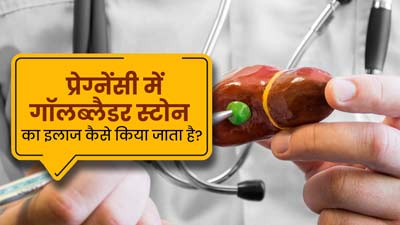 प्रेग्नेंसी में गॉलब्‍लैडर स्‍टोन का इलाज कैसे क‍िया जाता है? डॉक्‍टर से जानें 