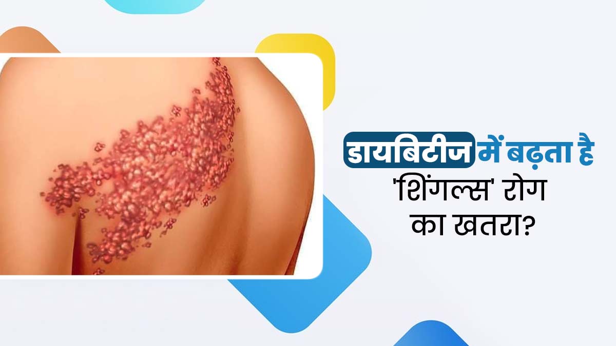 क्‍या डायब‍िटीज में बढ़ जाता है त्‍वचा के गंभीर रोग श‍िंगल्‍स (त्वचा पर दाने) का जोखिम? जानें दोनों में संबंध