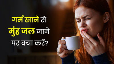 गर्म खाने से मुंह जल जाए, तो राहत के ल‍िए अपनाएं ये 5 घरेलू उपाय  