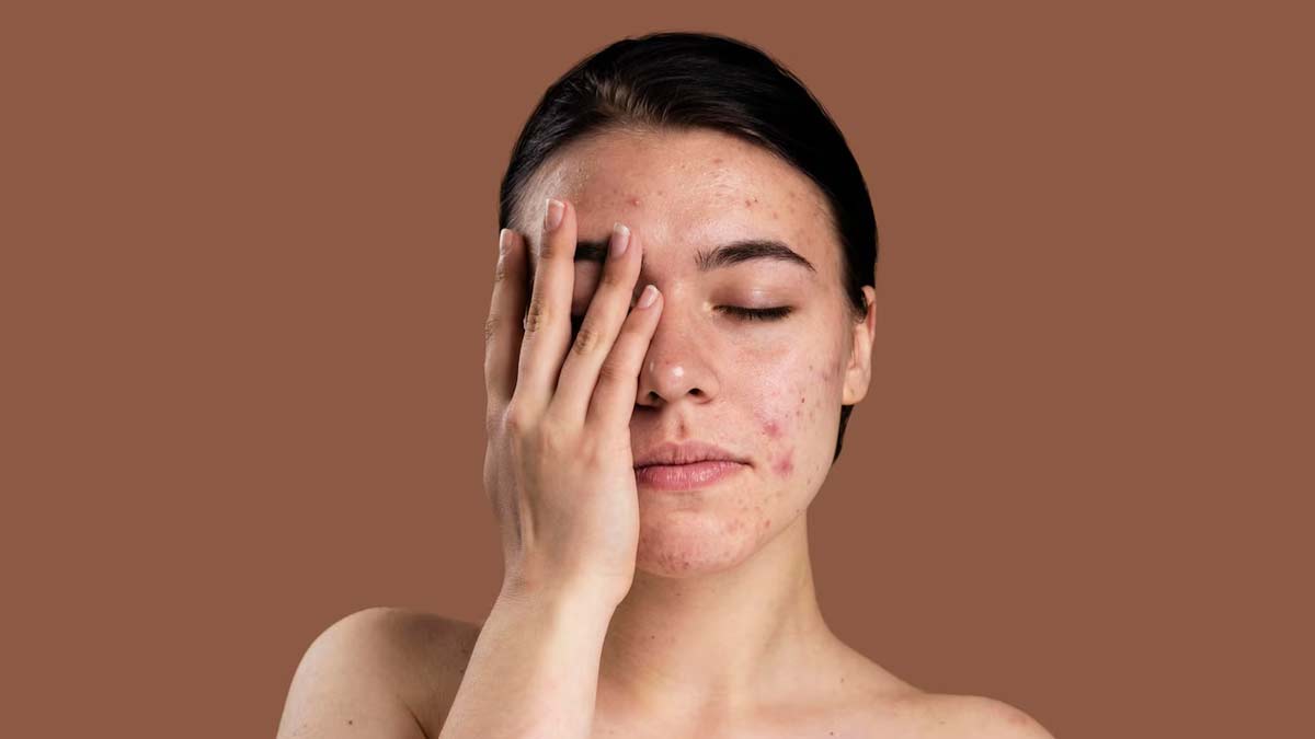 skin diseases