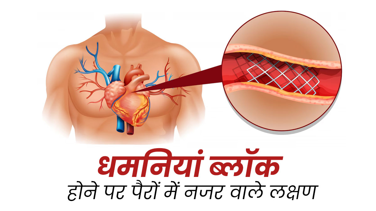 धमनियां ब्लॉक होने पर पैरों में नजर आते हैं ये 5 लक्षण, न करें अनदेखी