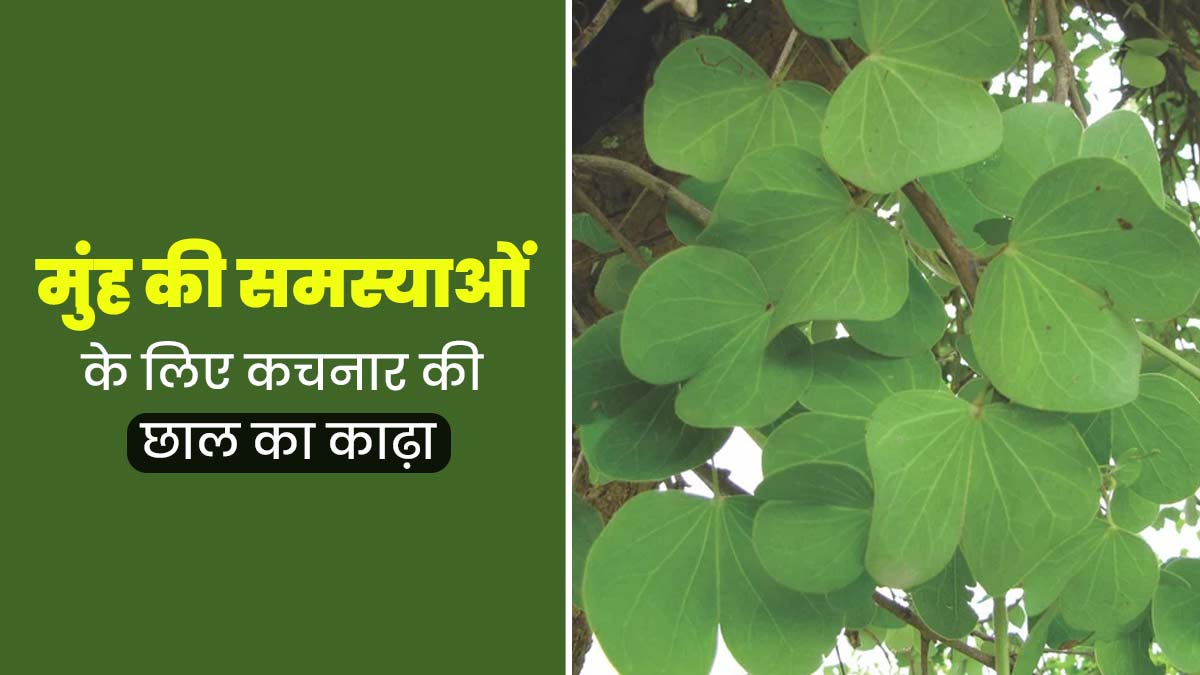 मुंह की समस्याओं में लाभदायक है कचनार की छाल का काढ़ा, जानें बनाने का तरीका