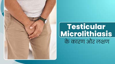 Testicular Microlithiasis: अंडकोष में कैल्शियम के छोटे-छोटे कण क्यों जमा हो जाते हैं? जानें लक्षण और कारण 