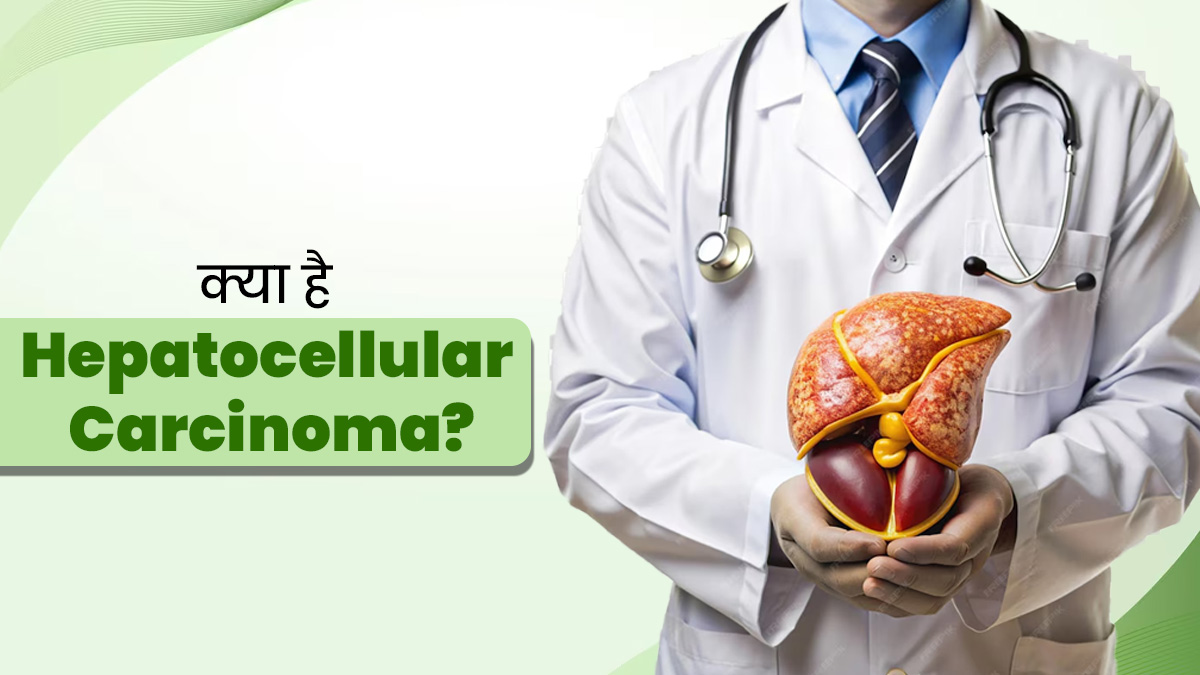 क्या है हेपैटोसेलुलर कार्सिनोमा? जानें इस लिवर कैंसर के लक्षण और कारण