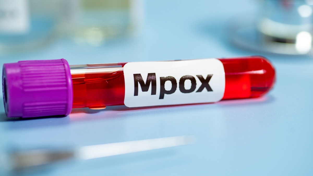 Mpox: A Public Health Emergency – How India Can Prepare For An Outbreak