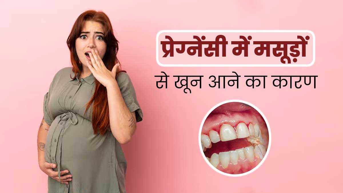 क्या प्रेग्नेंसी में गम ब्लीडिंग होना सामान्य है? डॉ. आस्था दयाल से जानें कारण और बचाव के उपाय