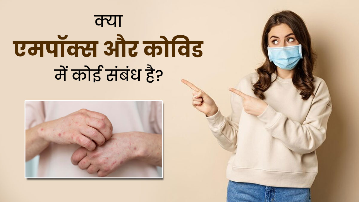 Mpox से नहीं है Covid 19 जैसी महामारी का खतरा, वायरस के बारे में पहले से है काफी जानकारी: WHO